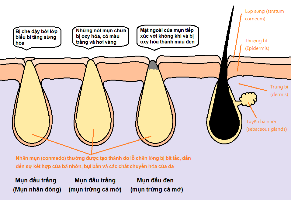 sữa rửa mặt q&a