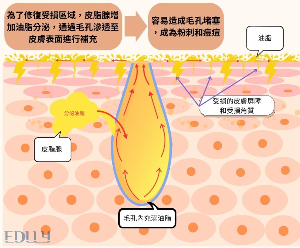 過度清潔-大量出油