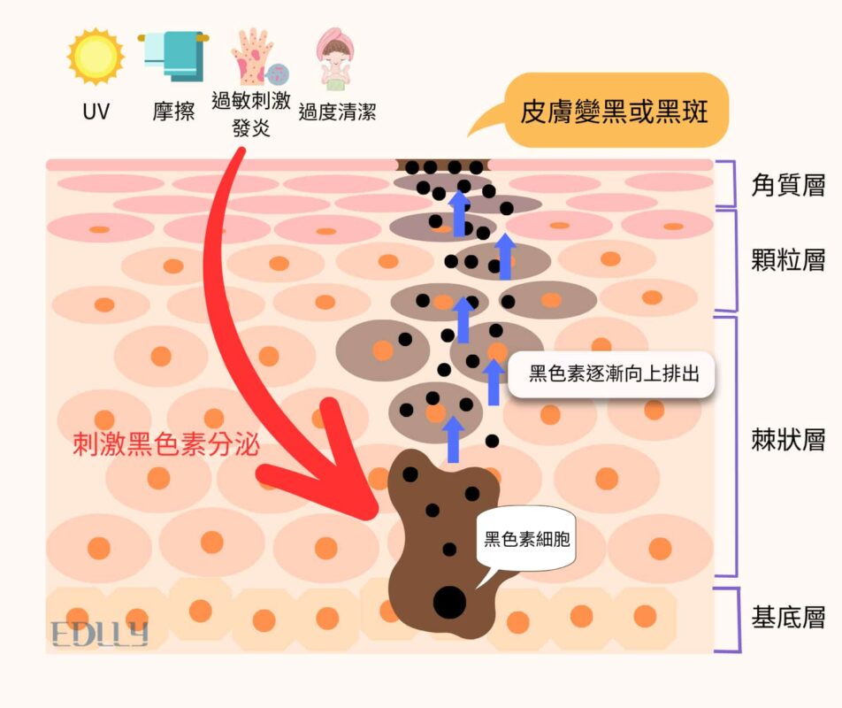 黑色素成因