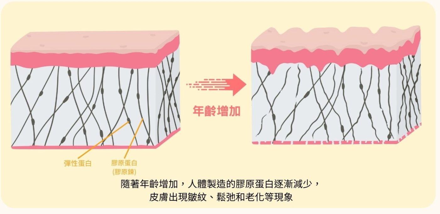 膠原蛋白減少不足